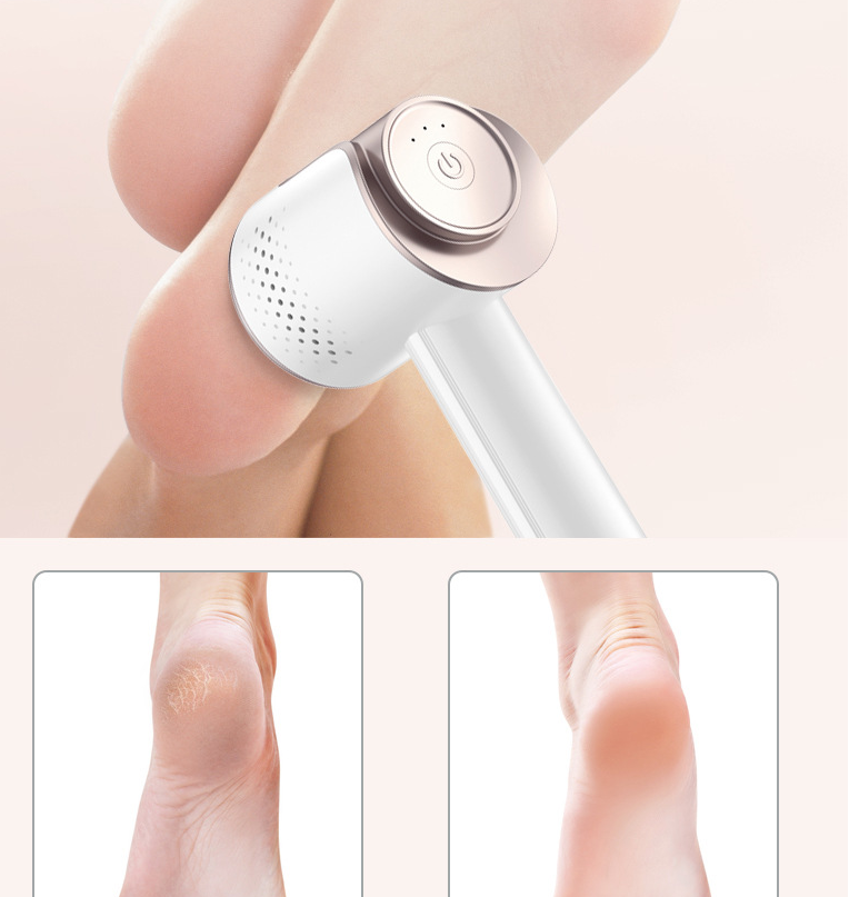 Baby Feet Callus Remover